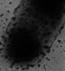
Yersinia enterocolitica